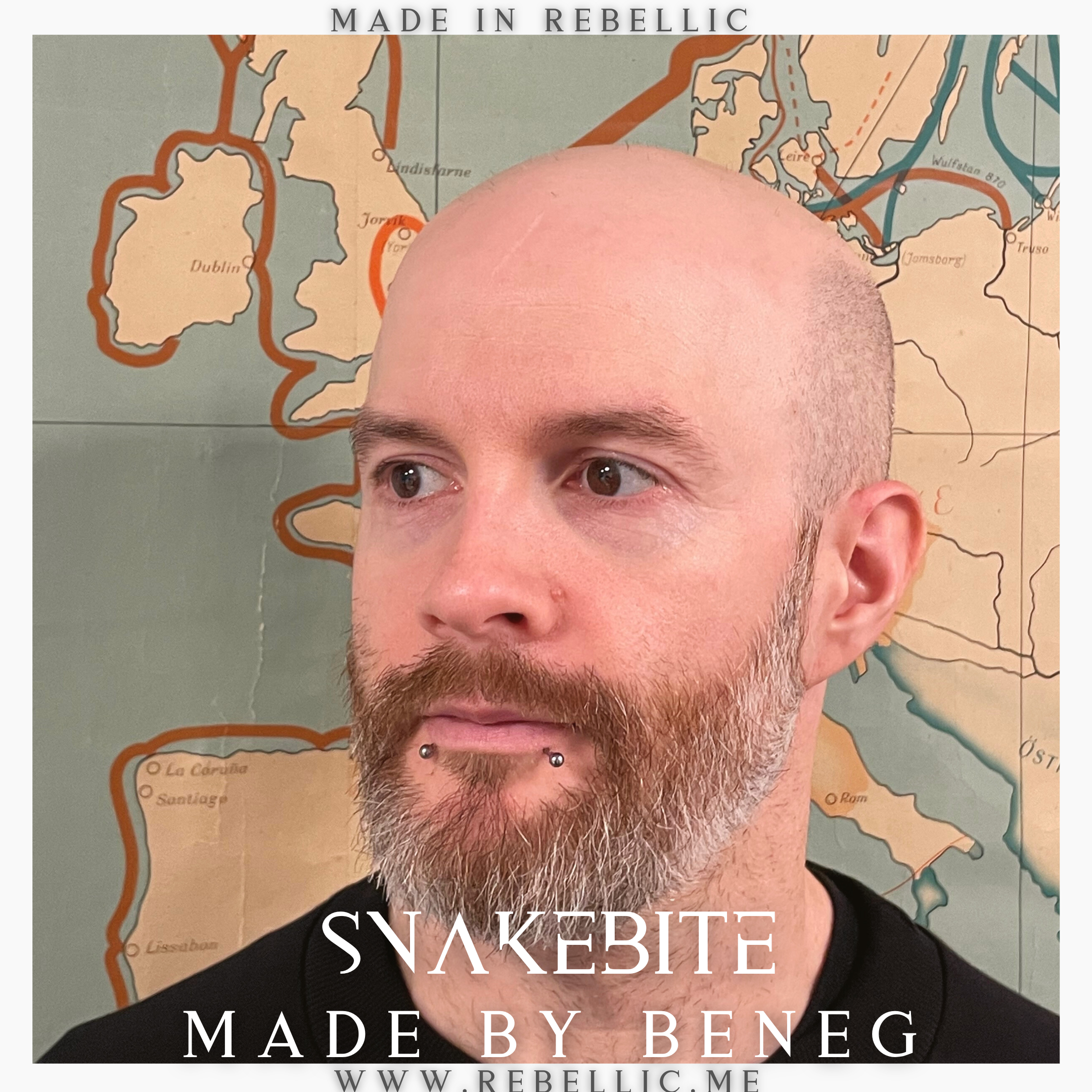Snakebite