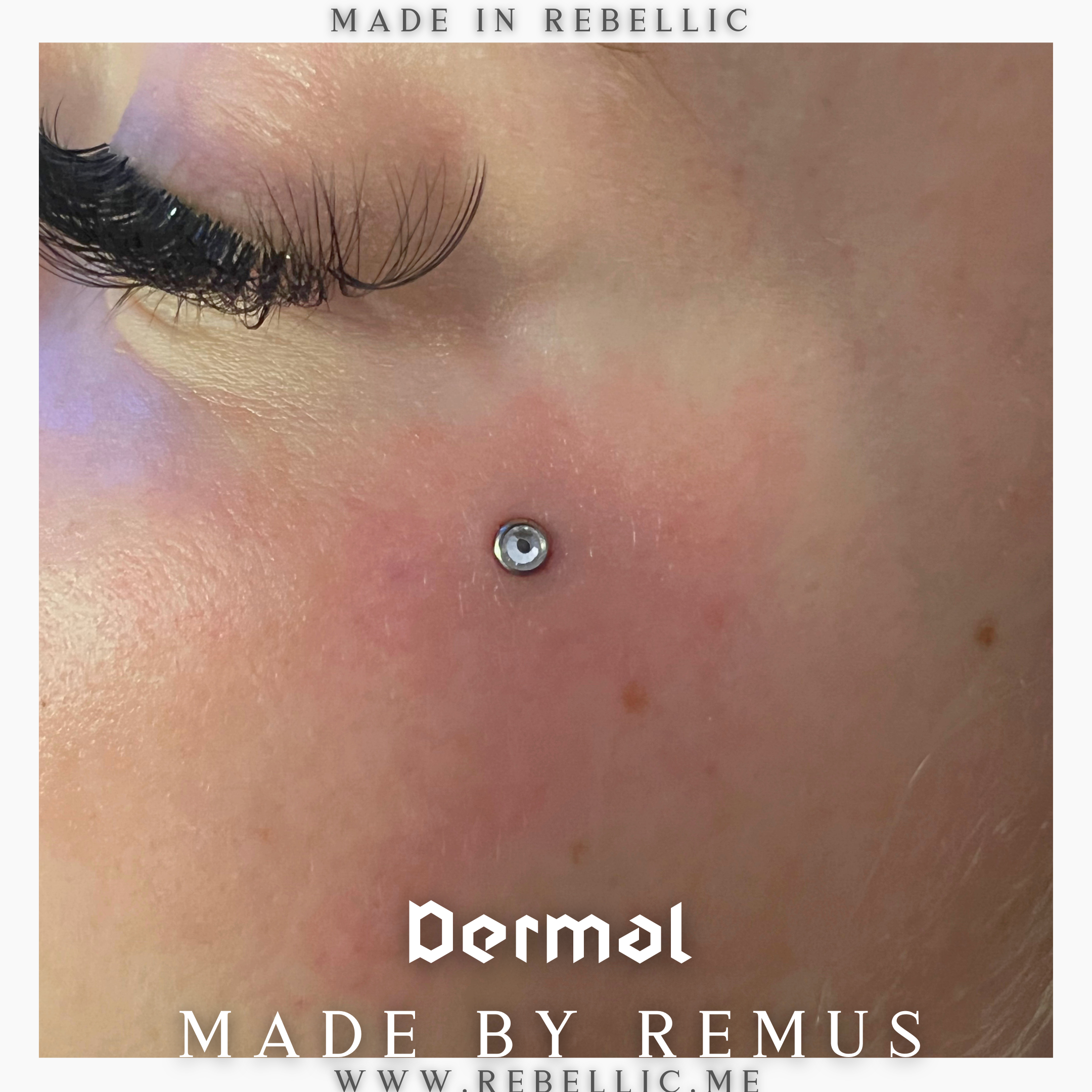 Dermal