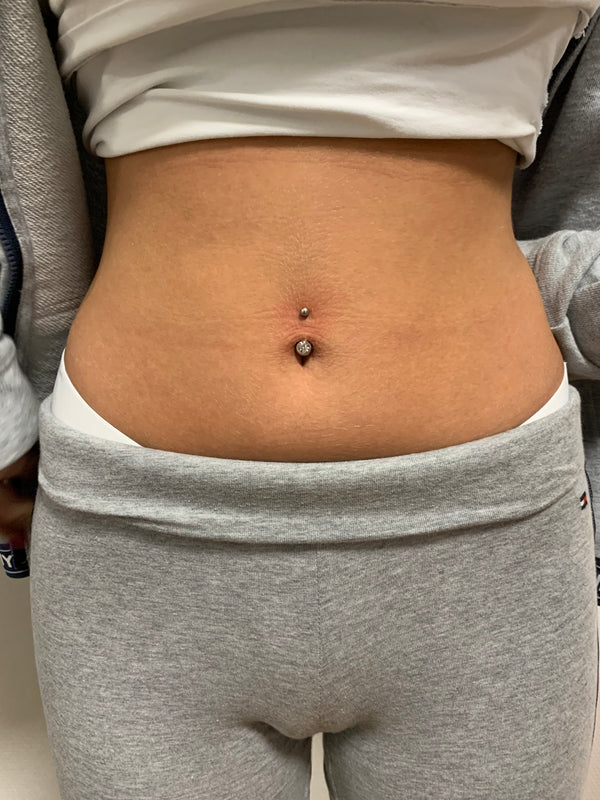 Aftercare Body Piercing